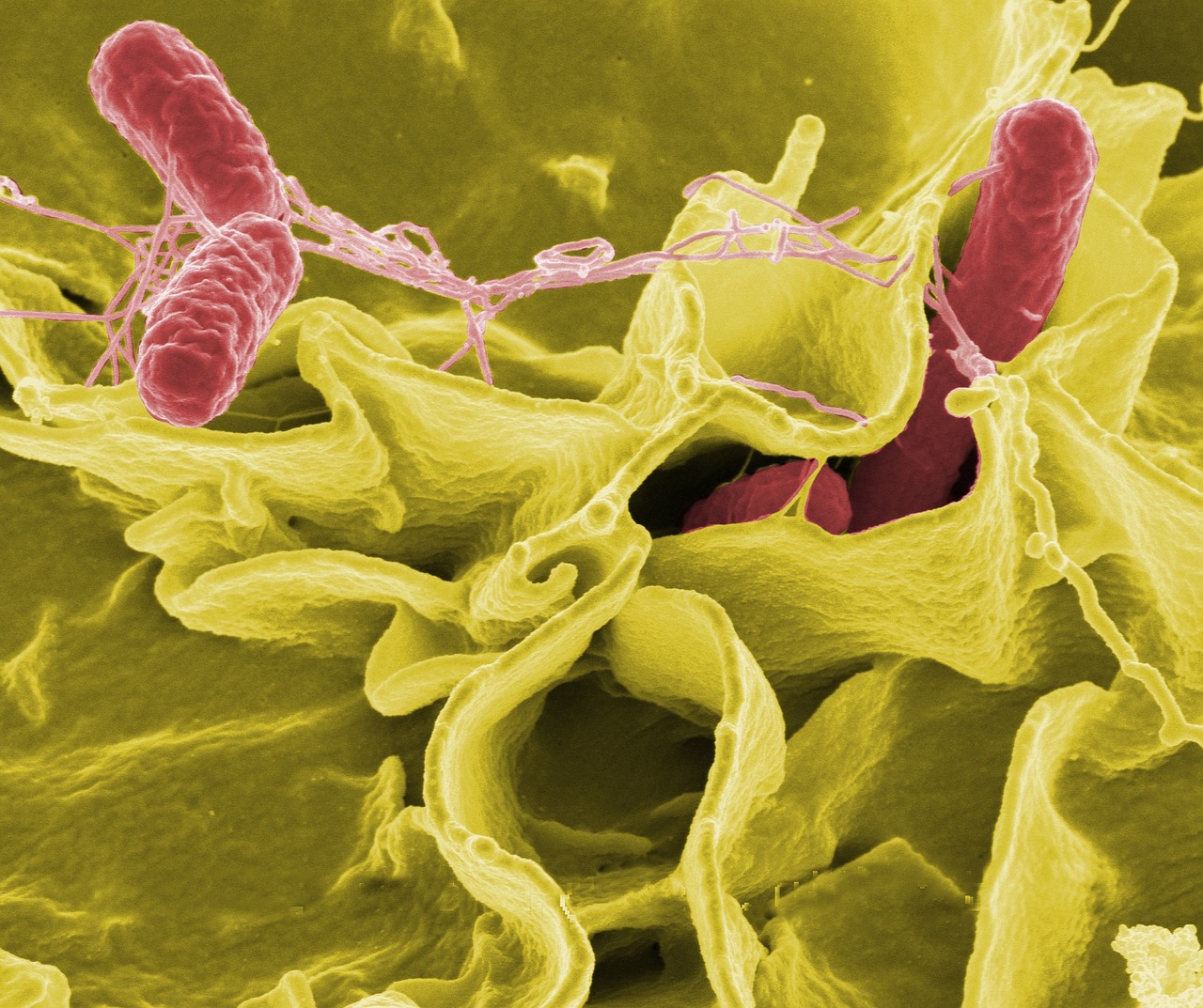 Wzrasta liczba opornych bakterii Escherichia coli